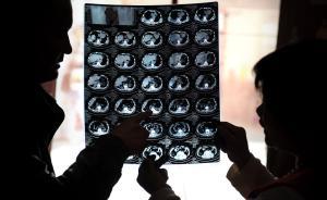 徐州官方通报“男子胸腔手术右肾缺失”事件：存在肾萎缩可能