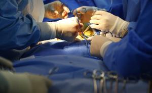 漲知識(shí)｜腎萎縮的案例并非絕無(wú)僅有，偷腎往往只是段子