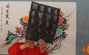 徐醫(yī)附院稱發(fā)現(xiàn)新證據(jù)：患者出院后復(fù)查胸部拍片顯示右腎萎縮