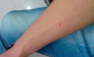 滬軌交1號(hào)線一乘客稱疑被針扎，警方：已排除人為可能