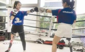 失去右腿又如何？愛美的“機械妞”不認命