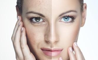 美白产品汞暴露：是否可以问责“阿里巴巴”们？