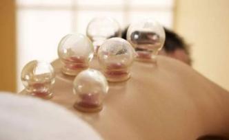 演員鄧莎自曝拔火罐被深二度燒傷，專家：這四類人要謹(jǐn)慎