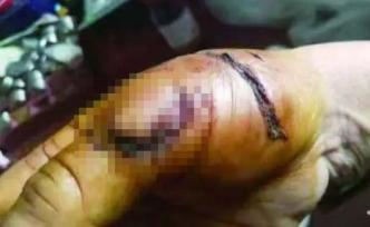 阜陽一藏獒突然撕咬75歲主人后又連續(xù)咬傷4人，被當(dāng)場擊斃