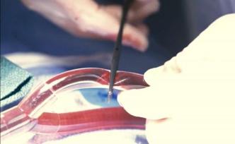 有一種出血不能止血，做錯了會要命的