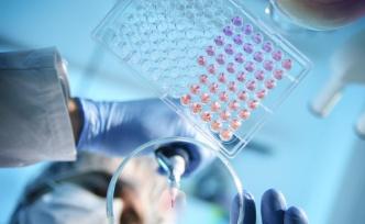 國家衛(wèi)健委：傳染病疫情形勢總體平穩(wěn)