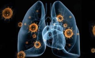 湖南一男子從湖北返回后未隔離致7人感染肺炎，警方立案偵查