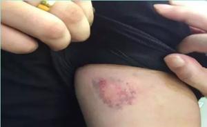 醉漢攜女子在上海地鐵逃票被抓后咬傷執(zhí)法者，賠償1500元