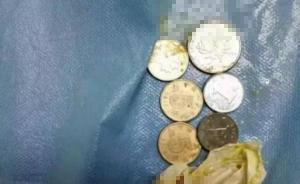 14岁男孩吞6枚硬币吓唬父母，专家提醒家长应学会情绪管理