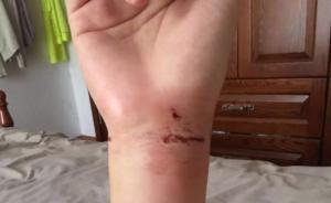 連云港“狗咬人”事件再發(fā)酵：狗的主人擬訴多家媒體和微信號(hào)