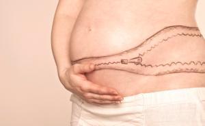 北京大学最新研究显示：全国各地剖宫产率两极分化显著