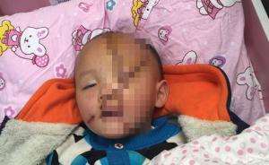 昆明1岁多幼童面部被划7刀毁容，年轻女邻居疑因小矛盾报复