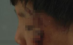 臨沂女子虐打男童被拘：孩子系花錢買來，是否涉拐賣兒童待查