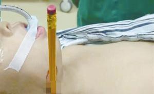 广西3岁小女孩玩耍时被铅笔插入脖子，医生：不要擅自拔出
