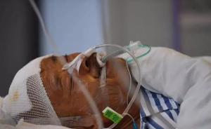 當(dāng)年九江大橋攔車英雄患重病無錢醫(yī)治