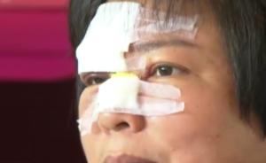 共享单车理赔首案：刹车失灵女子摔破脸