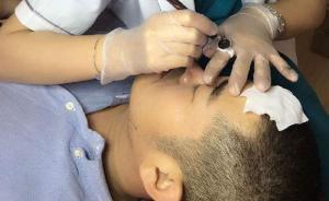 男子花费近万元纹眉未见效果，起诉退卡退费后获赔