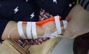 幼兒園多名兒童疑鼠藥中毒，吉林官方：檢錯(cuò)了，系食源性疾病