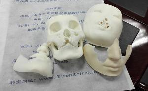 27歲女子在上?！皳Q臉”：幼年毀容，醫(yī)生在其胸部“造臉”