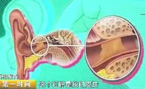 冷知識(shí)：正常人無需掏耳朵，越掏越栓塞