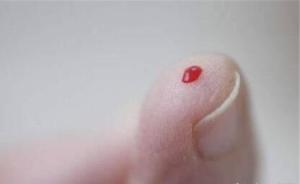 科研团队回应“滴血测癌”：测的是患癌风险，可辅助临床诊断