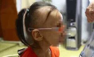 中國(guó)正在進(jìn)行全球首例干細(xì)胞治療早衰癥：能否讓患者返老還童