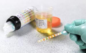 探秘毒品检验师：每天戴口罩工作，曾一天剥70多个“毒蛋”