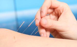 美重要医学杂志刊载两项中国针灸研究报告