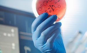 中科院院士：監(jiān)管免疫細(xì)胞治療，應(yīng)等同新藥研發(fā)