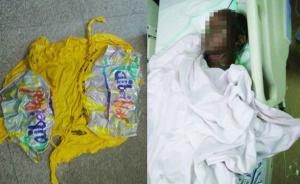 常熟一村民取氫氣球爆炸致2人燒傷,氣球被指來自上海嘉定