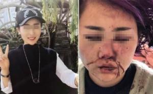 女子在丽江被打毁容案明开审，受害人称不出庭：心理创伤太重