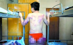 25歲男子興致勃勃去見女網(wǎng)友，卻被毆打勒索回來渾身傷 