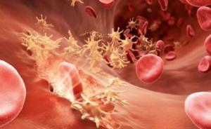 上海松江建轉(zhuǎn)基因藥物研發(fā)基地，血友病患者有望嘗試到新藥物