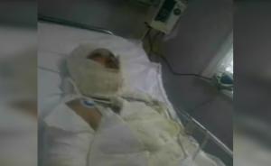 兄妹吵架哥哥自焚，妻子扑救被烧重伤