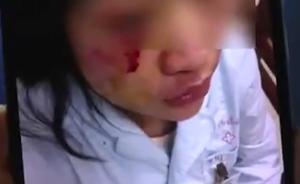 疑输液起争执，病人家属咬伤劝架护士眼