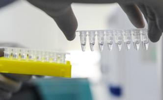 直播錄像丨解密核酸檢測(cè)，看新冠病毒基因如何破解