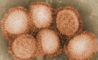 中疾控近九千新冠患者分析：老年男性風(fēng)險(xiǎn)大，R0為3.77