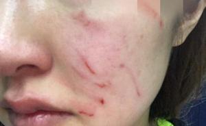 视频｜成都一女主持自曝遛狗未拴绳遭邻居暴打，责任尚无定论