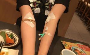 暖闻｜姑娘为白血病男孩捐干细胞，连打8针手臂成“马蜂窝”