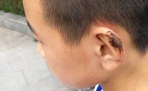 陕西宝鸡一中学140名师生上学途中被野蜂蜇伤，4学生伤重