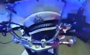 女童鸭骨卡喉，热心的哥求助交警开道