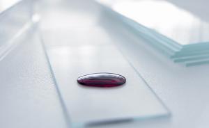 滴血驗(yàn)癌是否有臨床價(jià)值？專家：意義不大，不能作為診斷指標(biāo)