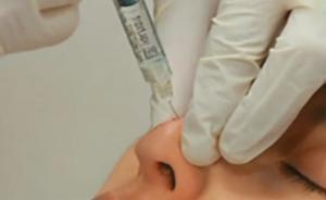 閨蜜網(wǎng)購玻尿酸互扎，誤扎血管險致失明