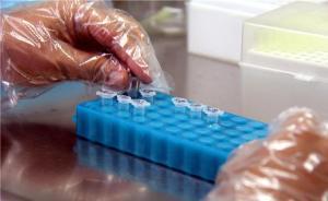 一口痰测肺癌：试剂盒已获准生产，可与影像学检测相互补充