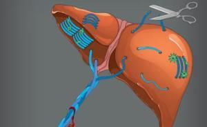 清華團隊首次從生物力學(xué)角度解析肝臟纖維化，為防治提供參考