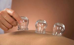 廣州一中醫(yī)館被曝廣泛使用“放血療法”，衛(wèi)計(jì)局扣繳涉醫(yī)物品