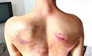 湖北男子偷渡緬甸賭博欠高利貸每天被打，警方跨國協(xié)調(diào)解救