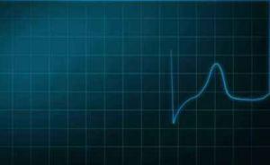 美科学家将身体运动转成射频信号：不碰皮肤即可监测生命体征