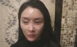 陪酒女模特額頭被酒杯砸出一個(gè)坑索賠十萬(wàn)：這張臉花了十多萬(wàn)