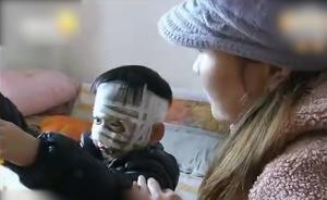 女子灑熱飲燙傷男童，稱怕被纏不敢露面